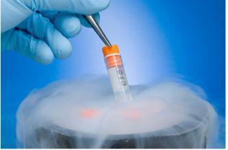 液氮存储